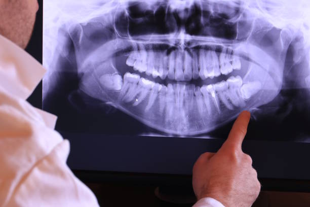Best After-Hours Emergency Dentist in Sesser, IL